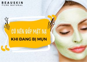 Có nên đắp mặt nạ khi đang bị mụn