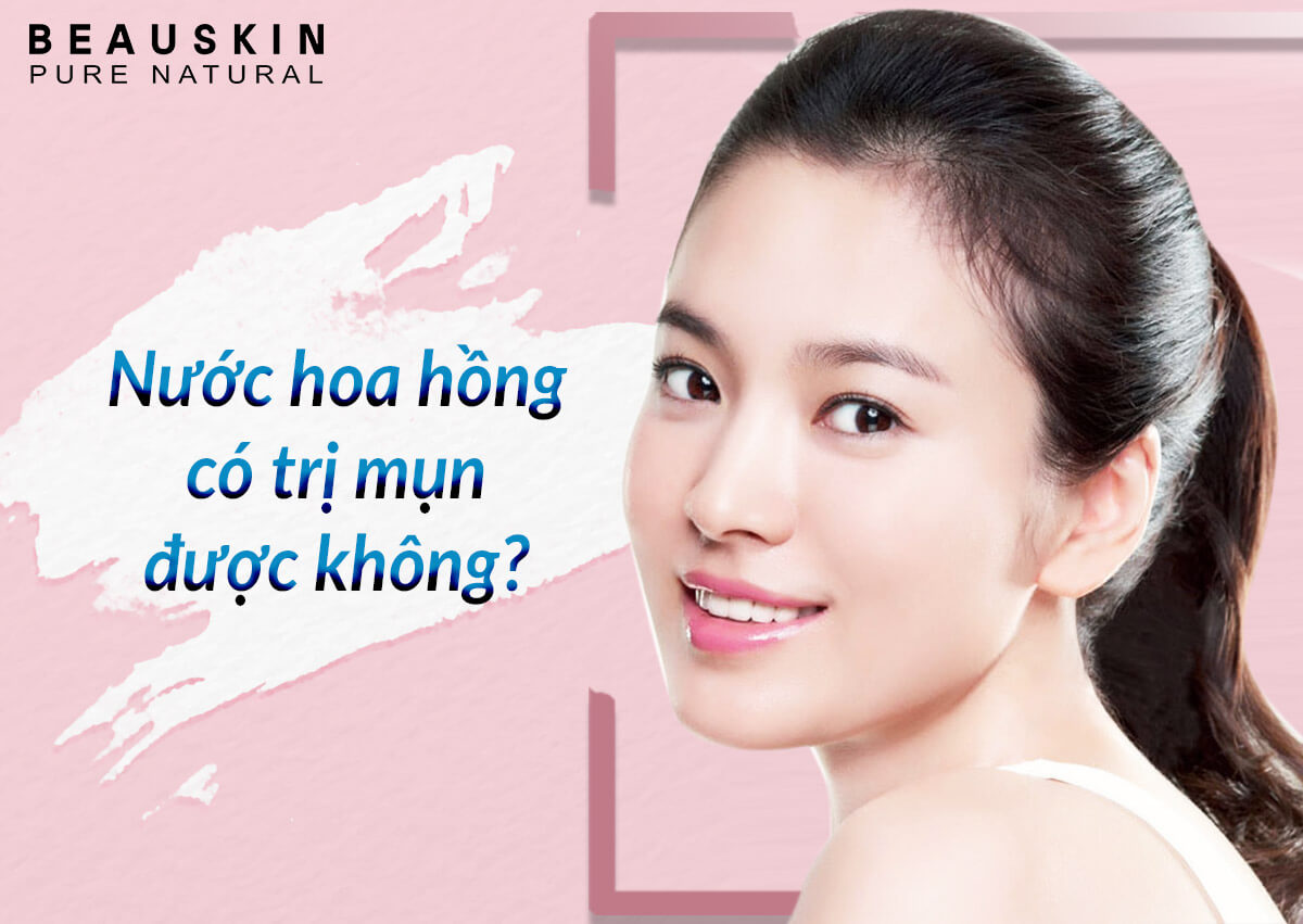NƯỚC HOA HỒNG CÓ TRỊ MỤN ĐƯỢC KHÔNG?