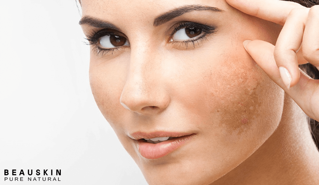 "Nỗi