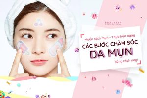 Chăm sóc da mụn theo công thức chuẩn chuyên gia Hàn Quốc