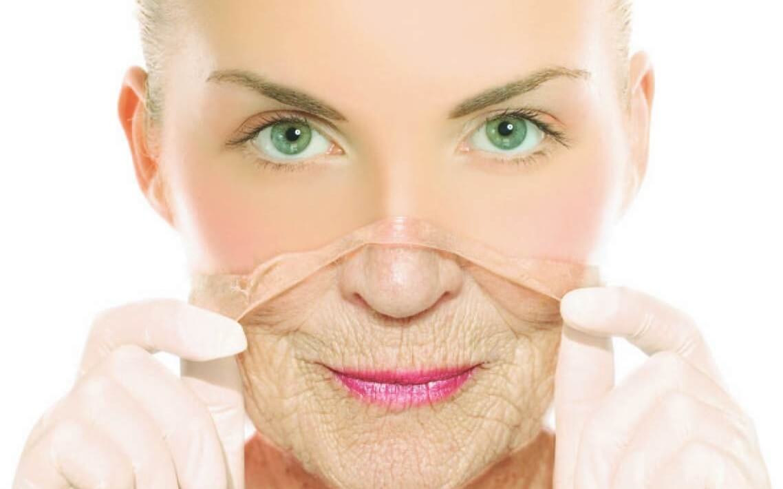 Mất collagen